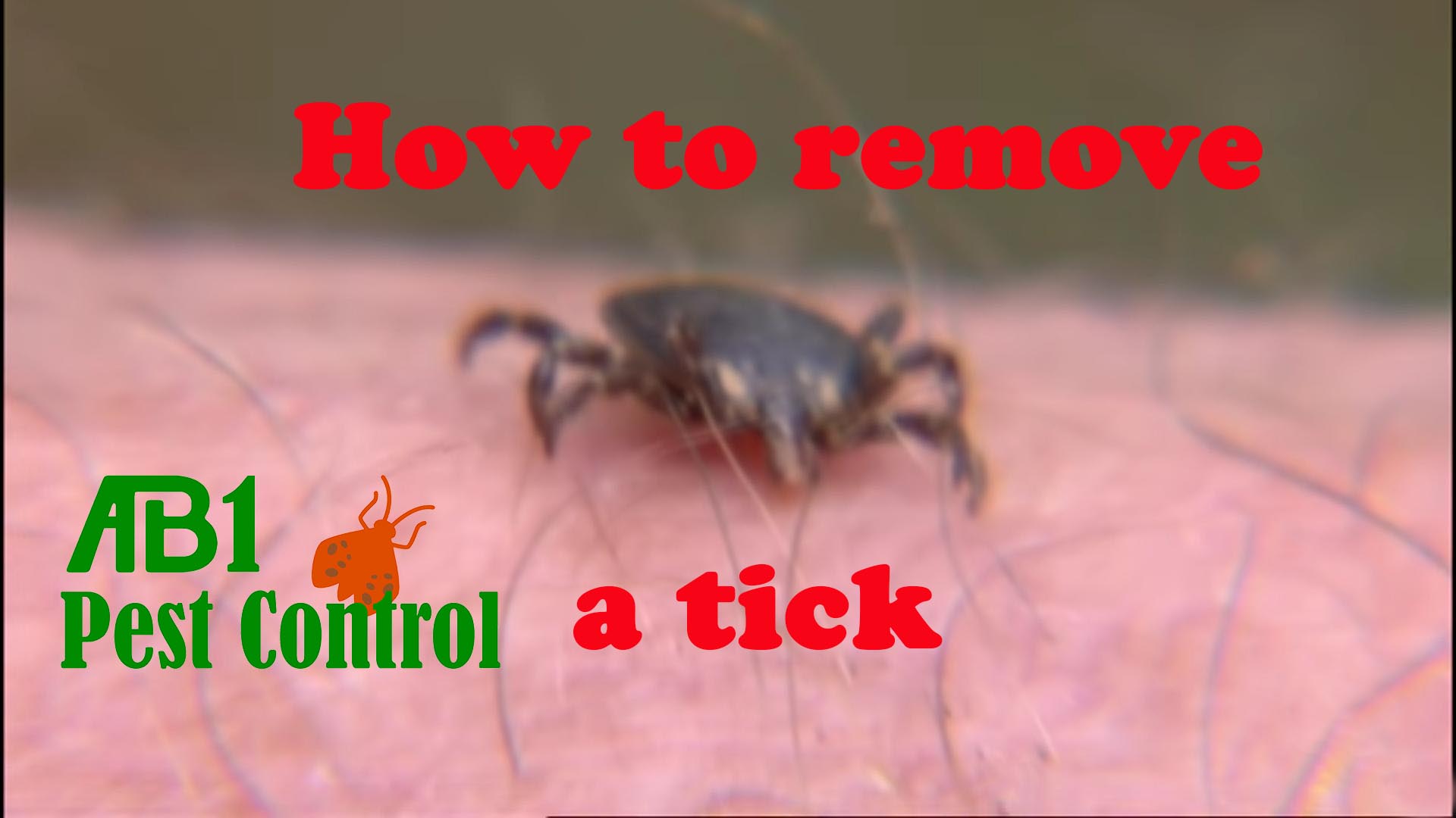 Tick removal